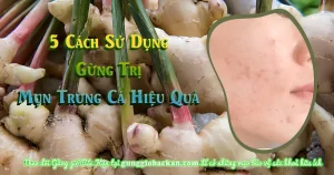 5 Cách Sử Dụng Gừng Trị Mụn Trứng Cá Hiệu Quả - gunggiobackan- gừng gió bắc kạn